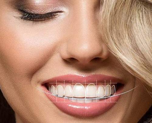 Digital Smile Design Planning